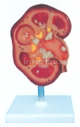 MIDDLE HUMAN KIDNEY MODEL